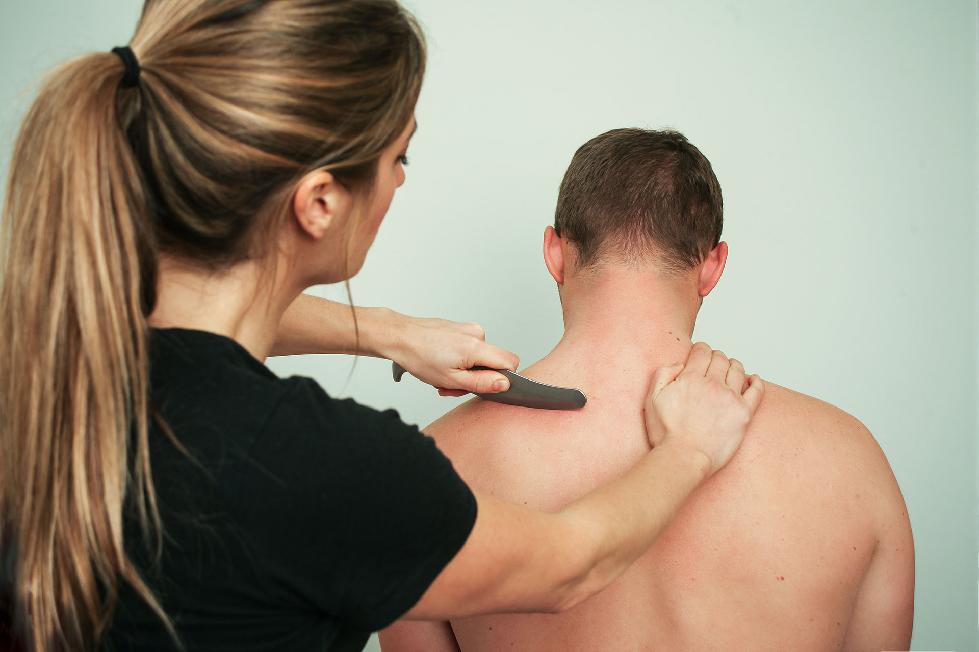 dry needling short course: Young woman undergoing acupuncture treatment, closeup